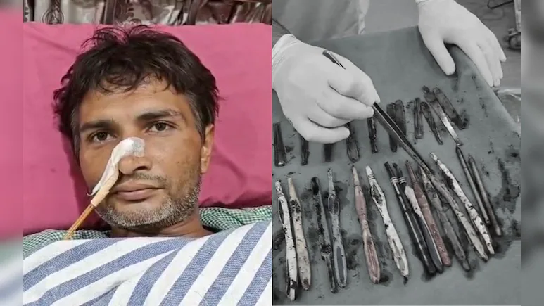 Surgeons remove 29 spoons, 19 toothbrushes, pens from patient’s stomach