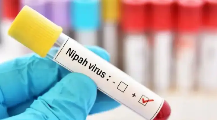 Nipah virus outbreak in India triggers Asia-wide health alert