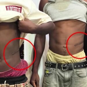 Atiku Abubakar raises concerns over reports of young Nigerians allegedly selling kidneys amid economic hardship.
