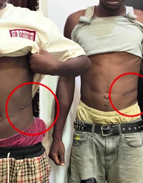 Atiku Abubakar raises concerns over reports of young Nigerians allegedly selling kidneys amid economic hardship.