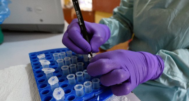 Africa CDC Director-General Jean Kaseya discusses the lack of an approved Bundibugyo Ebola vaccine and ongoing clinical trials.