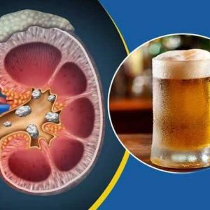 Kidney: Experts call for strict regulations on carbonated, alcoholic drinks